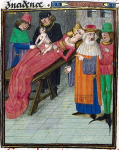 Medieval Depiction of Caesarian Birth